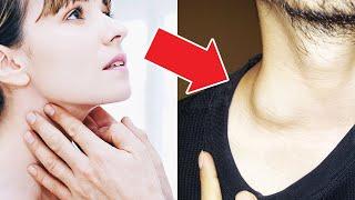 Воспаление лимфоузлов на шее: причины воспаления и увеличения лимфатических узлов