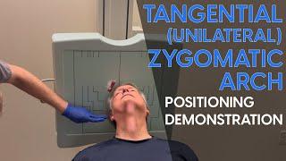 Tangential Unilateral Zygomatic Arch Radiographic Positioning Demonstration