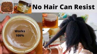 WORKS 100% When It Comes To Baldness & Alopecia, Thinning Hair. Do Not Wash It Out, use Daily.