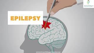 Epilepsy | Epilepsy Treatment in Thanjavur | Best Neurologist in India |