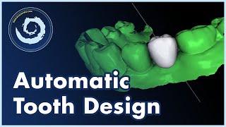 BSP V4.13: Automatic AI Tooth Design Now Available in Blue Sky Plan