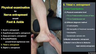 171.(의사용.Physical exam) Nerve entrapment 5(1)/6: Tarsal tunnel syndrome. 족근관 증후군 [강찬.충남대]