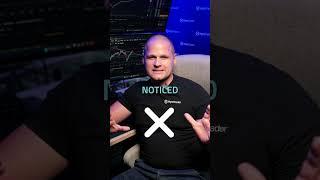 Don’t Force It! How Patience Wins in the Trading Game #shorts