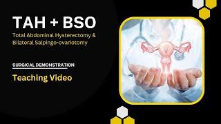 TAH + BSO | Hysterectomy | Bilateral Salpingo-ovaritomy | Teaching Video | Surgical Demo