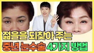 중년분들이 많이 하는 눈성형 4가지 방법! 아이크림? 필요 없어요!