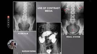 Introduction to Chest X ray 🩺 Part 1 of 4