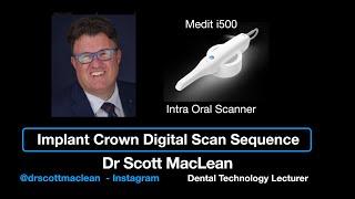 Dental Implant Crown Impression - Scanbody Pickup - Medit i500