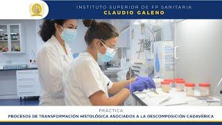Procesos de transformación histológica asociados a la descomposición | Anatomía Patológica