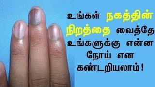 Nail|நகம்|உடல் ஆரோக்கியத்தை வெளிக்காட்டும் கண்ணாடி|நகத்தின் நிறத்தை வைத்து நோய்களைக் கண்டறியலாம்|