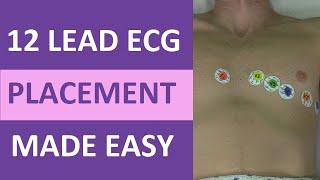 12 Lead ECG Placement Made Easy Nursing EKG Electrodes Interpretation