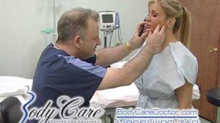 Liposculpture-chin_smartLipo chin