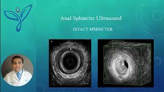 Urogynecology Testing