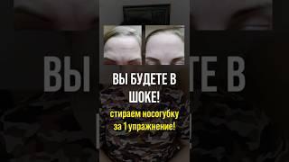 Сотру вашу носогубку НАВСЕГДА  подписывайтесь, выпуски каждый день!