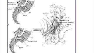 Pediatric Spine - ABOS Orthopedic Surgery Board Exam Review