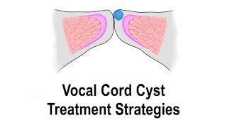 Vocal Cord Cyst Treatment Strategies  (Voice Therapy & Microflap Surgical Removal)