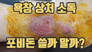 욕창 치료 시 포비돈 적용 방법, 올바른 상처 소독 방법