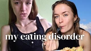 MY 6 YEAR EATING DISORDER RECOVERY STORY | Anorexia and Orthorexia Journey