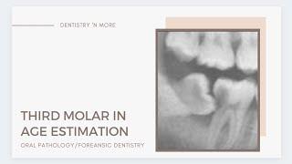 THIRD MOLARS IN AGE ESTIMATION