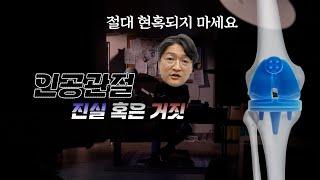 무릎 인공관절 수술 진실 혹은 거짓ㅣ재활치료는 필요 없다?ㅣ절대 현혹되지 마세요