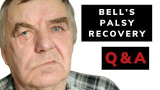 Bell's palsy recovery Q&A