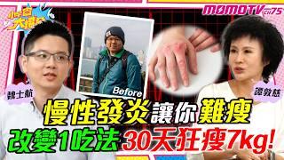 慢性發炎 讓你難瘦 改變1吃法30天狂瘦7kg! ft. 魏士航 醫師 譚敦慈【 小宇宙大爆發 】