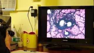Health and Natural Lifestyles - Blood Analysis