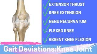 Gait Deviations: Knee Joint Complex Secondary to Knee Joint Dysfunction