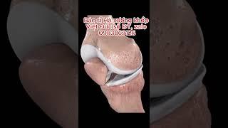 Chuyển động giải phẫu khớp gối