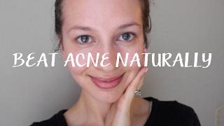 The Oil Cleansing Method, Beat Acne + Diet for Clear Skin | Alisha Leytem