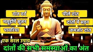 दातों में कीड़ा, दांत दर्द, पिले दांत का सिर्फ एक उपाय | एक चीज़ खालो | Buddha Teeth Cleaning Tips