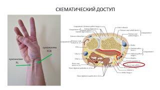 Ладонный доступ Генри к дистальному отделу лучевой кости. Перелом Бартона.Компартменты разгибателей.