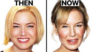 Renee Zellweger: Why She Looks So Different | Plastic Surgery Analysis