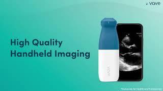 Vave Phased-Array Wireless Ultrasound | No subscription needed