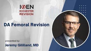 DA Femoral Revision - Jeremy Gililland, MD