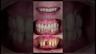 Oral repair