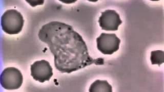 Lökosit bakteriyi kovalıyor/cell chasing bacteria.