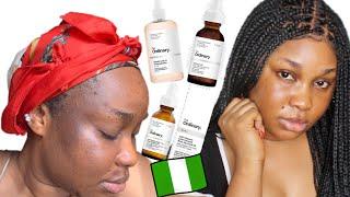 SKINCARE FOR BEGINNERS|I TRIED THE ORDINARY GLYCOLIC ACID,ALPHA ARBUTIN 2% FOR 30 DAYS|DEBORAH EMEM