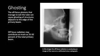 Off-Focus Radiation and Leakage; Definitions, Effects, and Regulations