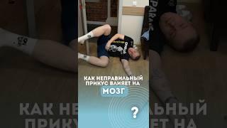 На что влияет неправильный прикус? #брекетымосква #стоматолог