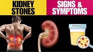 Are You at Risk? Key Signs And Symptoms of KIDNEY STONES Explained!