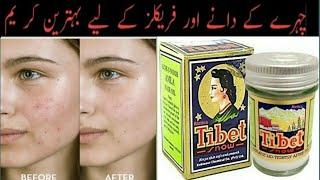 How To Use Tibet Snow Cream. Get White Bright And Spotless Skin. Hindi urdu.