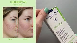 Isispharma Teen Derm A.Z | Ansiktskrem |  15% azelainsyre | Apotek For Deg