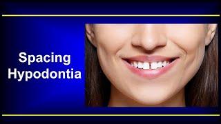 Dental Spacing / Hypodontia