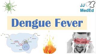 Dengue Fever | Pathophysiology, Symptoms, Diagnosis & Treatment