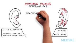 Ear, Nose, and Throat – Otalgia (Ear Pain): By Russell Hollins M.D.