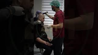 #shortsvideo #shortvideo #hairtransformation #hairtransplantationsurgery #hairstyle