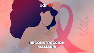 Reconstrucción mamaria después del cáncer de mama