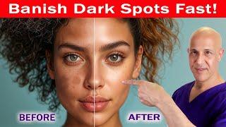 See a Change in 2-4 Days:  Banish Dark Spots, Hyperpigmentation, Melasma, & Acne Scars!  Dr. Mandell