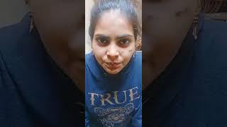 #funny #comedy #chandani kumari official 803