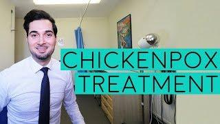 Chickenpox Treatment | Treatment For Chickenpox | Chickenpox Symptoms | Signs Of Chickenpox | 2018